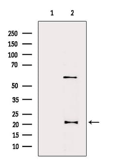 Invitrogen DHFR Polyclonal Antibody 100 &mu;L; Unconjugated:Antibodies,