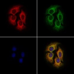 Invitrogen DHRS4 Polyclonal Antibody 100 &mu;L; Unconjugated:Antibodies,