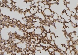 Invitrogen DHRS4 Polyclonal Antibody 100 &mu;L; Unconjugated:Antibodies,