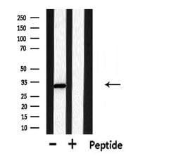 Invitrogen DHRS4 Polyclonal Antibody 100 &mu;L; Unconjugated:Antibodies,