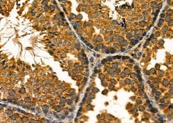 Invitrogen DIABLO Polyclonal Antibody 100 &mu;L; Unconjugated:Antibodies,