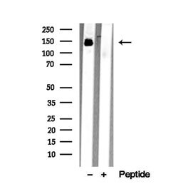 Invitrogen DIAPH1 Polyclonal Antibody 100 &mu;L; Unconjugated:Antibodies,