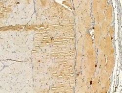 Invitrogen DIAPH3 Polyclonal Antibody 100 &mu;L; Unconjugated:Antibodies,