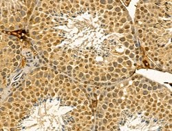 Invitrogen DIAPH3 Polyclonal Antibody 100 &mu;L; Unconjugated:Antibodies,