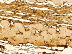 Invitrogen DIAPH3 Polyclonal Antibody 100 &mu;L; Unconjugated:Antibodies,