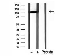 Invitrogen DIAPH3 Polyclonal Antibody 100 &mu;L; Unconjugated:Antibodies,