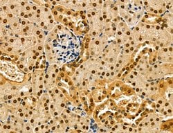 Invitrogen Dicer Polyclonal Antibody 100 &mu;L | Buy Online | Invitrogen&trade; | Fisher Scientific
