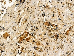 Invitrogen Dicer Polyclonal Antibody 100 &mu;L | Buy Online | Invitrogen&trade; | Fisher Scientific