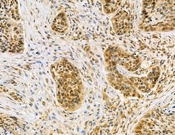 Invitrogen Dicer Polyclonal Antibody 100 &mu;L | Buy Online | Invitrogen&trade; | Fisher Scientific