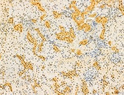 Invitrogen Dicer Polyclonal Antibody 100 &mu;L | Buy Online | Invitrogen&trade; | Fisher Scientific