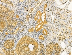 Invitrogen Dicer Polyclonal Antibody 100 &mu;L | Buy Online | Invitrogen&trade; | Fisher Scientific