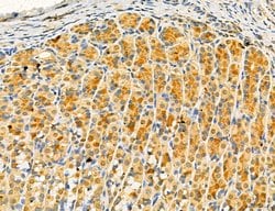 Invitrogen Dicer Polyclonal Antibody 100 &mu;L | Buy Online | Invitrogen&trade; | Fisher Scientific