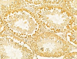 Invitrogen Dicer Polyclonal Antibody 100 &mu;L | Buy Online | Invitrogen&trade; | Fisher Scientific