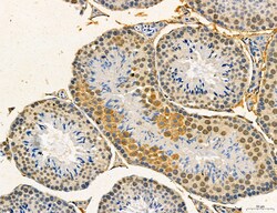 Invitrogen Dicer Polyclonal Antibody 100 &mu;L | Buy Online | Invitrogen&trade; | Fisher Scientific