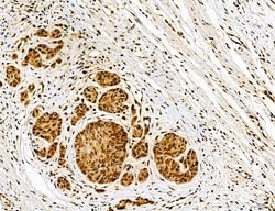 Invitrogen Dicer Polyclonal Antibody 100 &mu;L | Buy Online | Invitrogen&trade; | Fisher Scientific