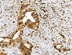 Invitrogen Dicer Polyclonal Antibody 100 &mu;L | Buy Online | Invitrogen&trade; | Fisher Scientific