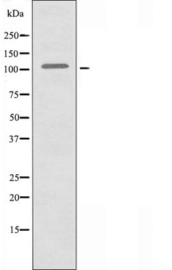 DNA Ligase IV Polyclonal Antibody, Invitrogen 100 &mu;L; Unconjugated:Antibodies,