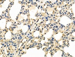 Invitrogen RNA pol II CTD Polyclonal Antibody 100 &mu;L; Unconjugated:Antibodies,