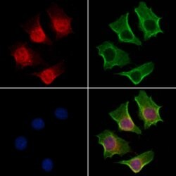 Invitrogen POLQ Polyclonal Antibody 100 μL; Unconjugated:Antibodies,