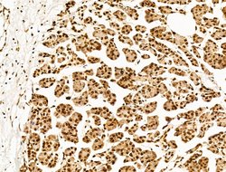 Invitrogen POLQ Polyclonal Antibody 100 μL; Unconjugated:Antibodies,