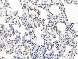 Invitrogen POLQ Polyclonal Antibody 100 μL; Unconjugated:Antibodies,