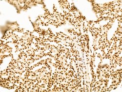 Invitrogen POLQ Polyclonal Antibody 100 μL; Unconjugated:Antibodies,