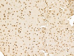 Invitrogen POLQ Polyclonal Antibody 100 μL; Unconjugated:Antibodies,
