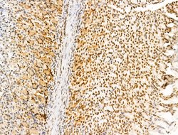 Invitrogen POLQ Polyclonal Antibody 100 μL; Unconjugated:Antibodies,