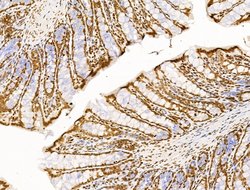 Invitrogen POLQ Polyclonal Antibody 100 μL; Unconjugated:Antibodies,