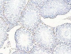 Invitrogen POLQ Polyclonal Antibody 100 μL; Unconjugated:Antibodies,