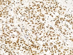 Invitrogen POLQ Polyclonal Antibody 100 μL; Unconjugated:Antibodies,
