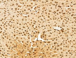 Invitrogen POLQ Polyclonal Antibody 100 μL; Unconjugated:Antibodies,