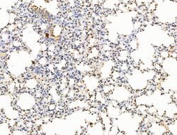 Invitrogen POLQ Polyclonal Antibody 100 μL; Unconjugated:Antibodies,
