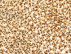 Invitrogen POLQ Polyclonal Antibody 100 μL; Unconjugated:Antibodies,
