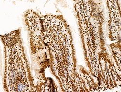 Invitrogen POLQ Polyclonal Antibody 100 μL; Unconjugated:Antibodies,