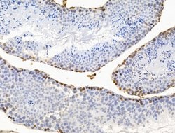Invitrogen POLQ Polyclonal Antibody 100 μL; Unconjugated:Antibodies,