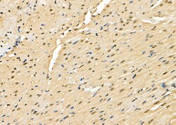 Invitrogen HDJ2 Polyclonal Antibody 100 &mu;L; Unconjugated:Antibodies,