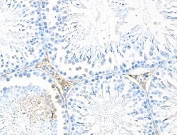 Invitrogen DNase II Polyclonal Antibody 100 &mu;L; Unconjugated:Antibodies,