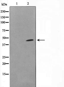 Invitrogen DOK6 Polyclonal Antibody 100 &mu;L | Buy Online | Invitrogen&trade; | Fisher Scientific