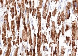 Invitrogen DOK7 Polyclonal Antibody 100 &mu;L | Buy Online | Invitrogen&trade; | Fisher Scientific