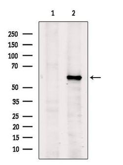 Invitrogen DOK7 Polyclonal Antibody 100 &mu;L | Buy Online | Invitrogen&trade; | Fisher Scientific