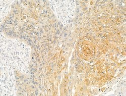 Invitrogen DPP9 Polyclonal Antibody 100 &mu;L; Unconjugated:Antibodies,