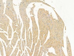Invitrogen DPP9 Polyclonal Antibody 100 &mu;L; Unconjugated:Antibodies,