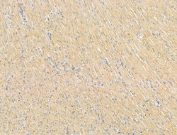 Invitrogen DPP9 Polyclonal Antibody 100 &mu;L; Unconjugated:Antibodies,