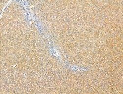 Invitrogen DPP9 Polyclonal Antibody 100 &mu;L; Unconjugated:Antibodies,