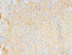 Invitrogen DPP9 Polyclonal Antibody 100 &mu;L; Unconjugated:Antibodies,