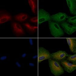 Invitrogen DRD2 Polyclonal Antibody 100 &mu;L; Unconjugated:Antibodies,