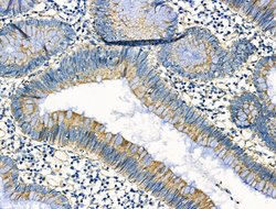 Invitrogen DRD2 Polyclonal Antibody 100 &mu;L; Unconjugated:Antibodies,