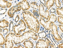 Invitrogen DRD2 Polyclonal Antibody 100 &mu;L; Unconjugated:Antibodies,