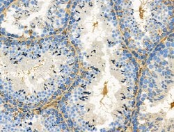 Invitrogen DRD2 Polyclonal Antibody 100 &mu;L; Unconjugated:Antibodies,